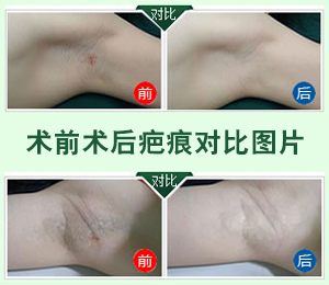 术前术后效果对比.jpg